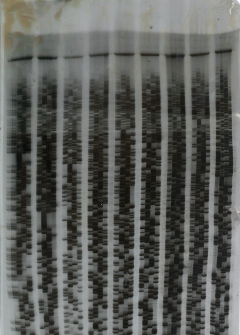 electrophoresis